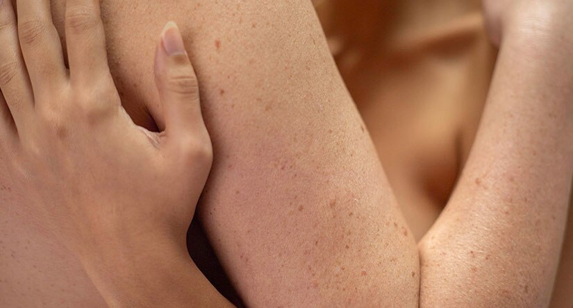 Hudens mikrobiom gavnlige bakterier på huden Hudens mikrobiom gavnlige bakterier på huden